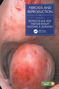 Fibroids and Reproduction 1st Edition – PDF ebook