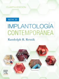 Misch. ImplantologÃa contemporánea 4th Edition – PDF ebook