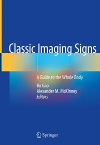Classic Imaging Signs: A Guide to the Whole Body 1st Edition – PDF ebook