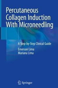 Percutaneous Collagen Induction With Microneedling: A Step-by-Step Clinical Guide – PDF ebook
