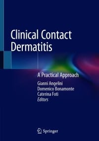 Clinical Contact Dermatitis: A Practical Approach – PDF ebook