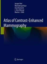 Atlas of Contrast-Enhanced Mammography – PDF ebook
