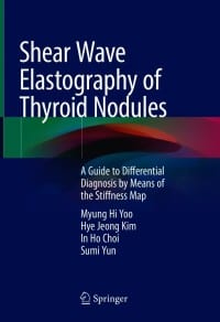 Shear Wave Elastography of Thyroid Nodules: A Guide to Differential Diagnosis by Means of the Stiffness Map – PDF ebook