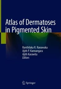 Atlas of Dermatoses in Pigmented Skin 1st Edition – PDF ebook