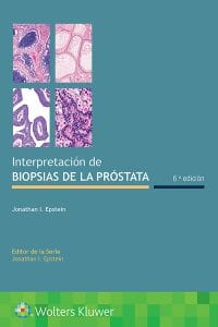 Interpretación de biopsias de la próstata 6th Edition – PDF ebook