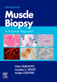 Muscle Biopsy: A Practical Approach 5th Edition – PDF ebook