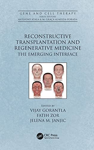 Reconstructive Transplantation and Regenerative Medicine: The Emerging Interface (Gene and Cell Therapy) – PDF ebook