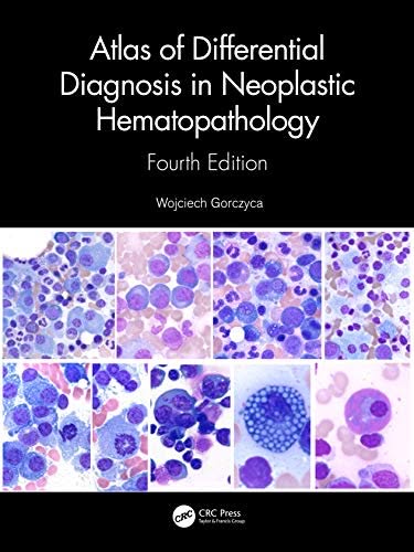 Atlas of Differential Diagnosis in Neoplastic Hematopathology, 4th Edition – PDF ebook