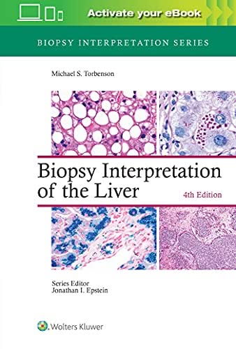 Biopsy Interpretation of the Liver (Biopsy Interpretation Series), 4th Edition – PDF ebook