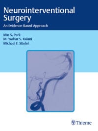 Neurointerventional Surgery: An Evidence-Based Approach – PDF ebook