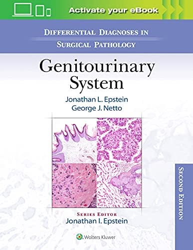 Differential Diagnoses in Surgical Pathology: Genitourinary System, 2nd edition – PDF ebook