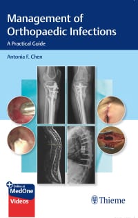 Management of Orthopaedic Infections: A Practical Guide – PDF ebook