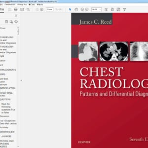 Chest Radiology Patterns and Differential Diagnoses – PDF ebook