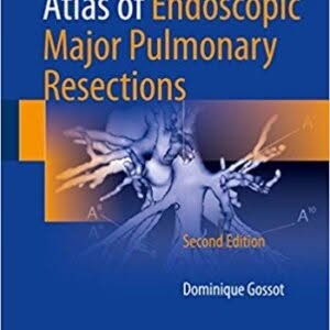 Atlas of Endoscopic Major Pulmonary Resections 2nd Edition – PDF ebook